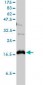 CLDN1 / Claudin 1 Antibody (clone 1C5-D9)